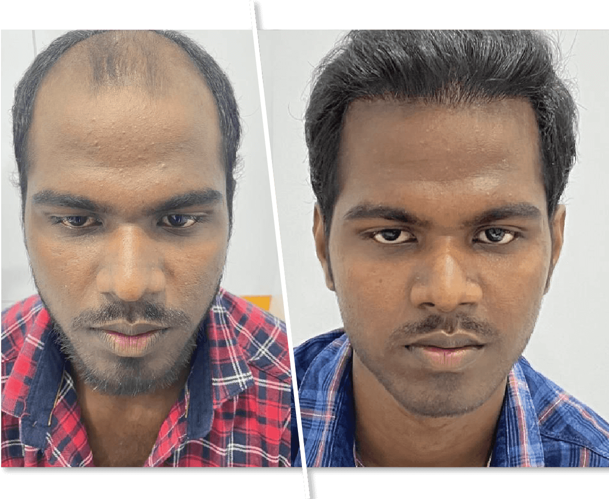 ব্যবহারের পর ফলাফল 1