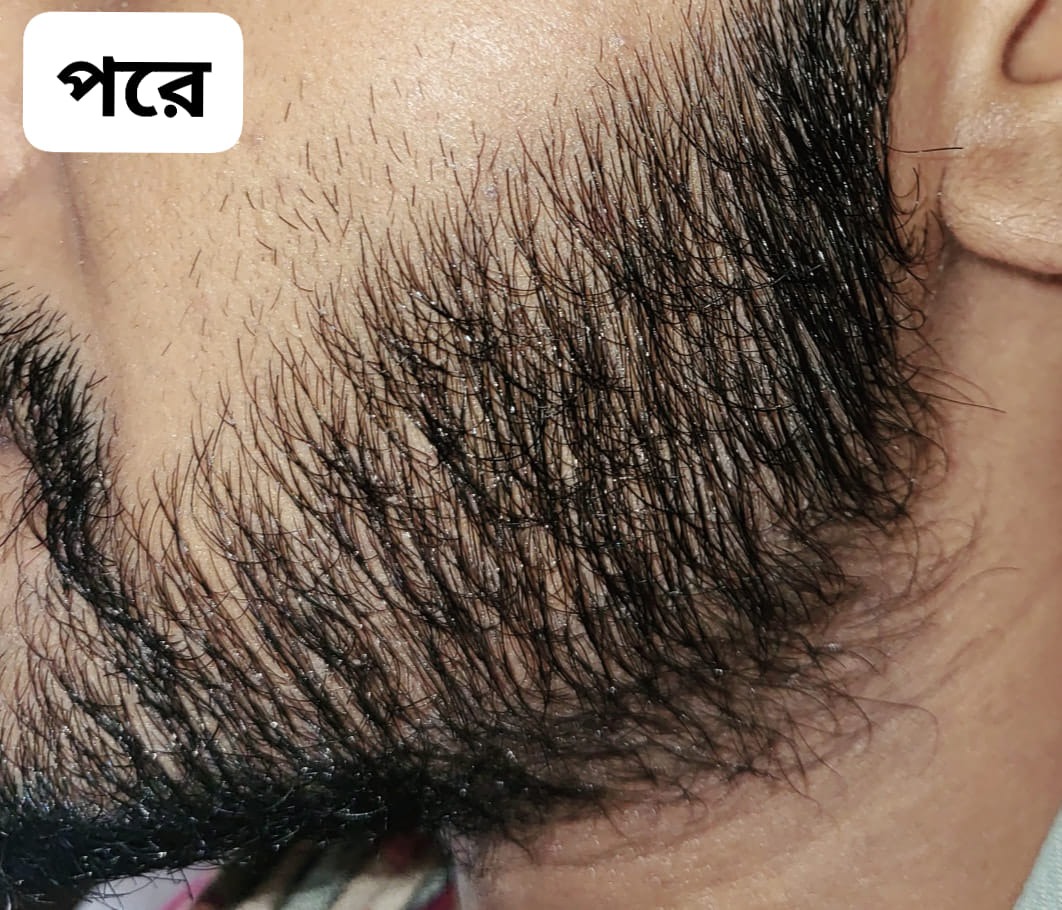 ব্যবহারের পর ফলাফল 6