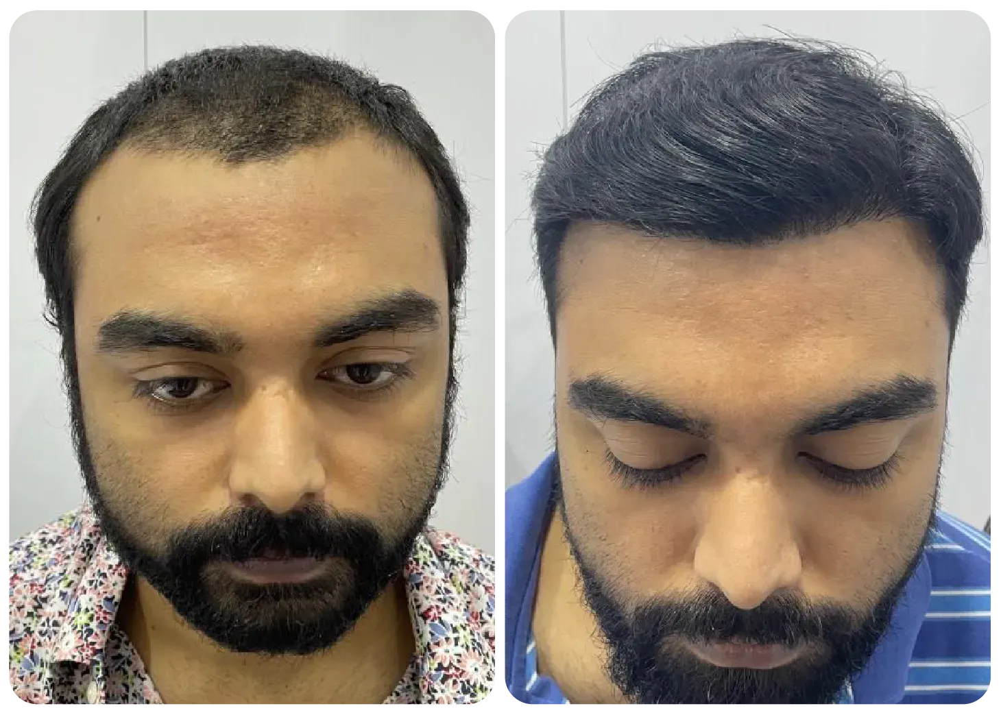 ব্যবহারের পর ফলাফল 2