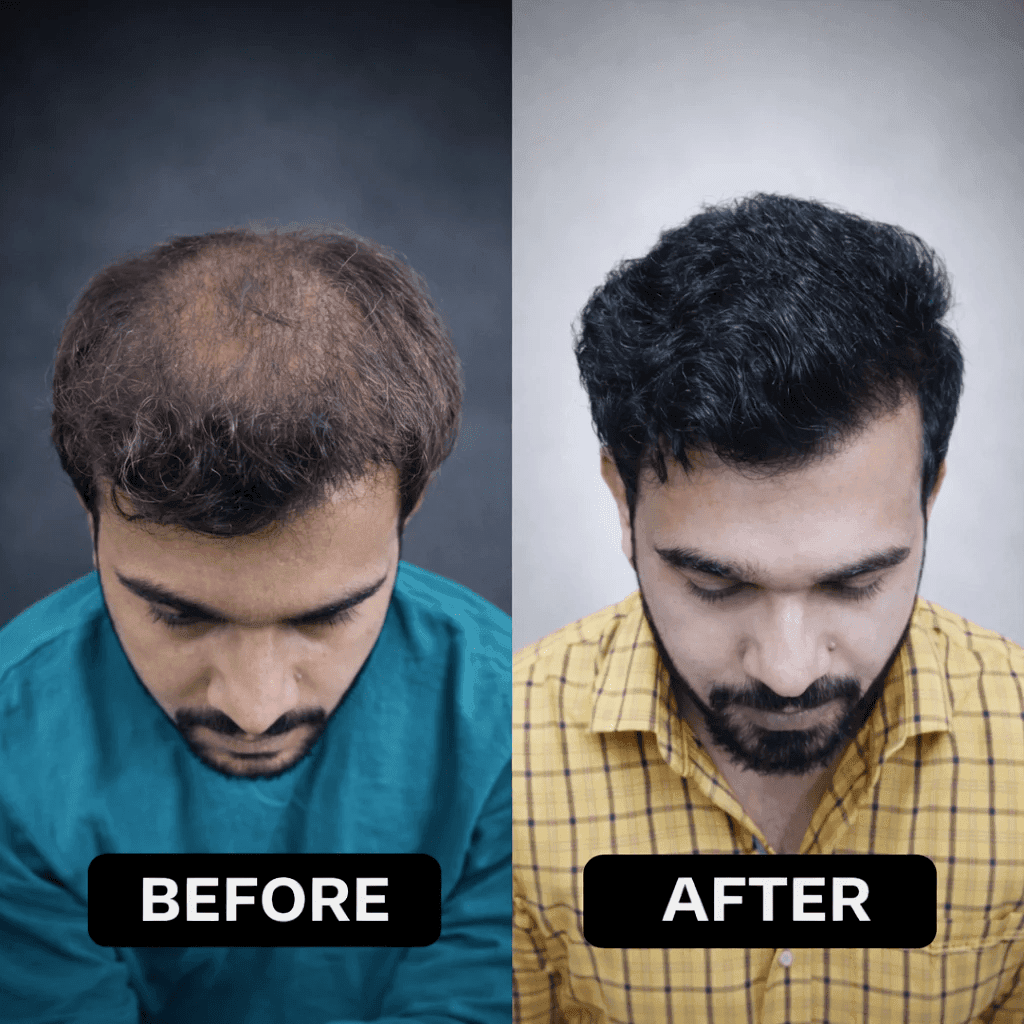 Hair Result 3