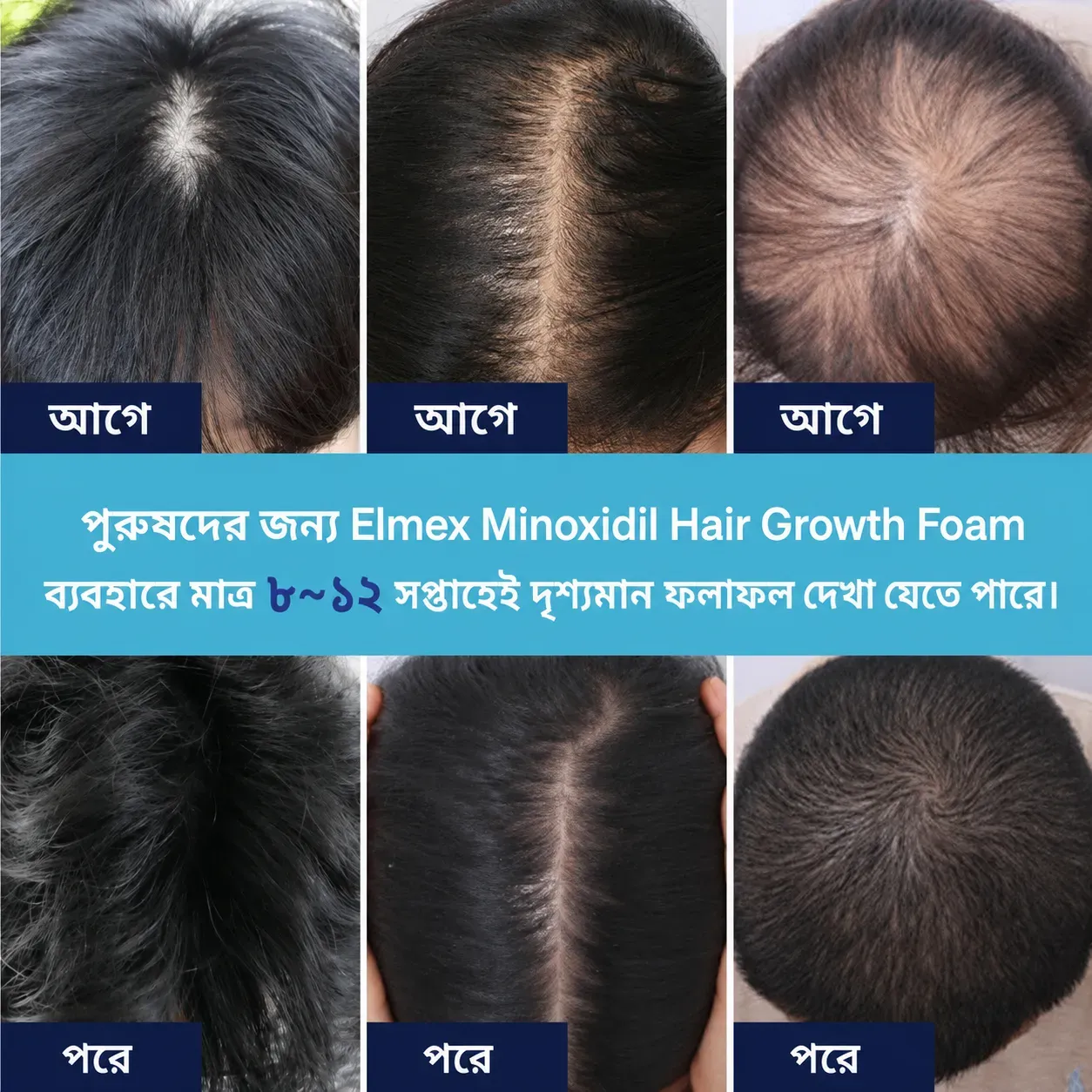 AvitaPure Minoxidil Spray